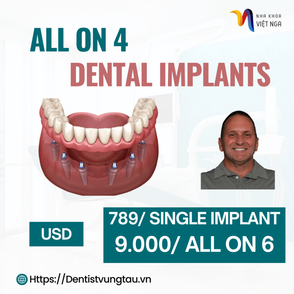 all on 6 dental implants cost